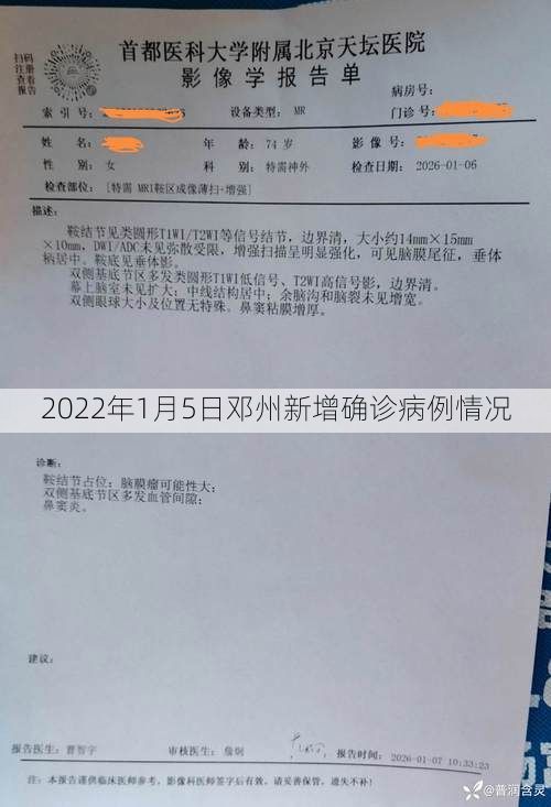 2022年1月5日邓州新增确诊病例情况